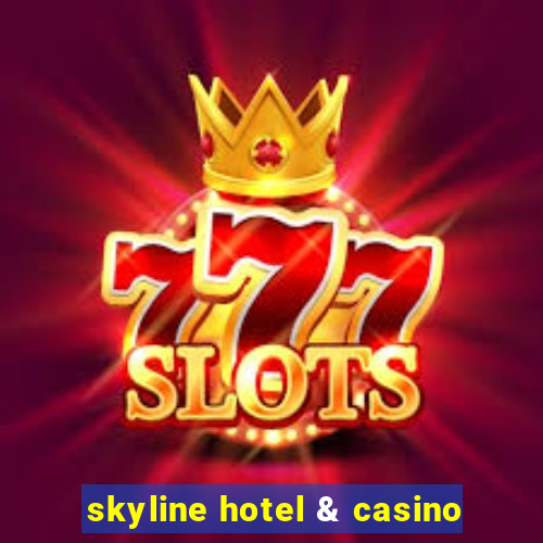 skyline hotel & casino