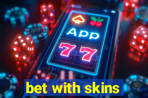 bet with skins