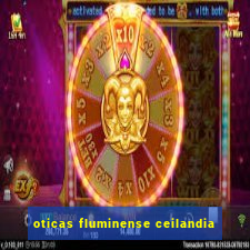 oticas fluminense ceilandia